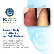 Load image into Gallery viewer, Wrap-E-Soothe Ultra-Soft Non-Itch Eczema Arm or Leg Sleeves for Adults &amp; Teens (Medium 11"-18"), Eco-Friendly Tencel Eczema Clothing, No Zinc or Dyes, USA Made
