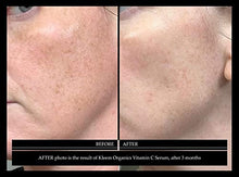 Load image into Gallery viewer, Vitamin C Serum &amp; Retinol Cream for Face Bundle - Natural &amp; Organic Anti Aging Skin Care Set for Men &amp; Women to Reduce Wrinkles and Dark Spots
