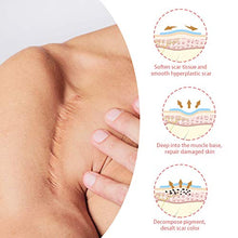 Load image into Gallery viewer, Lancs Acne Scar Removal Serum Skin Repair Essence for Reduces the Appearance of Old &amp; New Scars, Wrinkles, Burns and Recovery Scar Treatment (5ml7 bottles)
