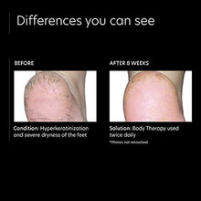 Load image into Gallery viewer, PCA SKIN Daily Body Therapy Lotion - Rich 12% Lactic Acid Moisturizing Cream to Nourish Dry Skin, Fragrance-Free, Non-Greasy Formula (7 oz)
