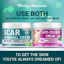 Load image into Gallery viewer, Scar Removal Cream - Effective Stretch Mark Removal - Natural Skin Repair - Acne Scar Remover Cream - Made in USA - Advanced Treatment for Old Scars &amp; Acne Scars - Clinically Proven Formula - 2 OZ
