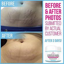 Load image into Gallery viewer, Stretch Mark Cream for Pregnancy &amp; Scar Removal - 100% Retinol Free - Mommy Knows Best Maternity Stretch Marks Cream Removal Treatment with Cocoa and Shea Butter - Clinically Proven - 4 fl oz
