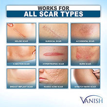 Load image into Gallery viewer, Vanish Silicone Scar Gel | Extra-strength Silicone Scar Removal Cream for Face, Body Stretch Marks, Keloid Scar, Acne Scar, C-Section and Surgical Scars | Old &amp; New Scars, for Men and Women | 1oz
