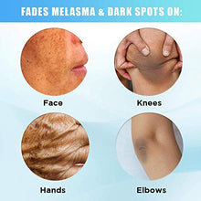 Load image into Gallery viewer, 2% Hydroquinone Dark Spot Corrector Whitening Cream, Skin Bleaching Cream Lightening Cream Hyperpigmentation Melasma Treatment with Kojic Acid, Alpha Arbutin, Salicylic Acid, Niacinamide, Azelaic Acid
