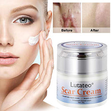 Load image into Gallery viewer, Scar Cream, Stretch Mark Cream, Acne Scar Removal Cream, Acne Spots Treatment, Burns Repair, Face Skin Repair Cream(50g)
