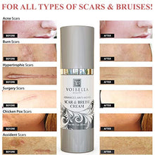 Load image into Gallery viewer, Scar &amp; Bruise Removal Cream - Best Treatment Remedy for Healing, Skin Repair, Fading &amp; Prevention of Old or New Acne &amp; Stretch Mark, Surgical, Keloid, C Section, Pregnancy or Bug Bite Scars &amp; Bruises

