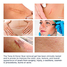 Load image into Gallery viewer, Scar Remover Gel for Scars from C-Section, Stretch Marks, Acne, Surgery, Effective for both Old and New Scars
