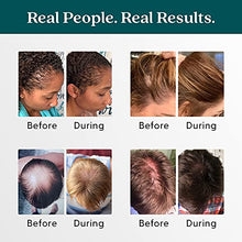 Load image into Gallery viewer, Shapiro MD Natural Hair Kit for Thicker, Fuller, Healthier Looking Hair - Including Shampoo, Conditioner, and Leave-In Daily Foam (2 Month)
