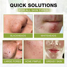 Load image into Gallery viewer, Blackhead Peel Off Face Mask, SHVYOG 3-in-1 Blackhead Remover Charcoal Mask with Brush &amp; Tea Tree Serum, Purifying &amp; Deep Cleansing Black Mask for Blackheads, Dirt, Acne, Pores Shrinking (100g+30ml)
