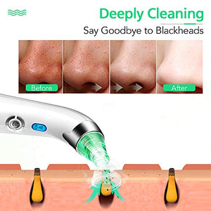 Blackhead Remover Pore Vacuum Cleaner - LONOVE Upgraded Blackhead Vacuum Rechargeable Face Vacuum Comedone Extractor Tool for Blackhead Whitehead Acne Removal, 5 Adjustable Suction Power and 4 Porbes