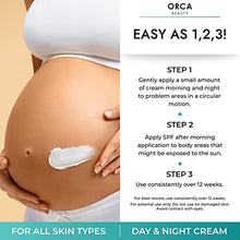Load image into Gallery viewer, Belly Butter For Pregnancy Belly Cream - Stretch Mark Remover Body Butter For Women - Anti Stretch Mark Cream For Pregnancy - Firming Moisturizing Stretch Mark Cream Remover With Shea And Cocoa Butter
