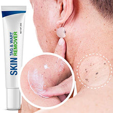 Load image into Gallery viewer, Pureskin Safe &amp; Effective Formula Skin Tag Remover Patches Set, Skin Tag Removal Patches Set with Natural Ingredients for Your Skin Tag
