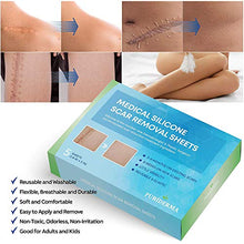 Load image into Gallery viewer, Puriderma Medical Silicone Scar Removal Sheets [Set of 5] - Fast &amp; Effective on Keloid, Surgery, Burn, Acne, C-Section Scars

