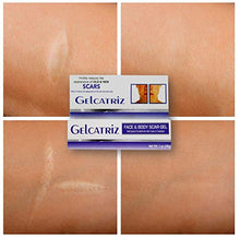 Load image into Gallery viewer, Gelcatriz Scar Treatment Gel | Scar Removal Gel for Diminishing the Visible Appearance of Acne Scars, Surgery Scars, Stretch Marks, Cuts &amp; Scrapes, and more; 1 Ounce Tube
