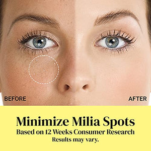 Milia Remover Milia Spot Treatment Helps Dissolve and Reduce Milia in 4 weeks with natural ingredients 0.5 oz by SUNHEAL