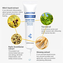 Load image into Gallery viewer, Face Herb Extract Acne Pimple Gel for Remove Acne Spots Comedone + Moisturizing Repairing Acne Mark (20 g)
