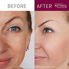 Load image into Gallery viewer, Retinol Anti-Aging Gel Cleanser – Gently Cleans Impurities From Pores &amp; Exfoliates for Soft, Smooth Skin – Antioxidant-Rich Micro-Beads w/ Vitamin A &amp; E Maximize Renewing Benefits Of Retinol
