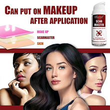 Load image into Gallery viewer, Ebanel Advanced Silicone Scar Gel, Scar Removal Cream for Old &amp; New Scars of Acne, Surgical, C-Section, Injuries, Burn, Cuts, Insect Bites, Stretch Marks with Vitamin E, Emu Oil, Onion Extract
