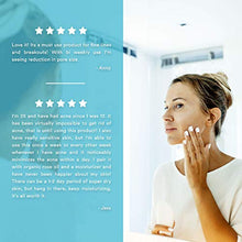 Load image into Gallery viewer, Glycolic Acid 50% Gel Peel - Enhanced with Retinol &amp; Green Tea Extract (Professional Skin Peel)1 ounce
