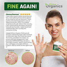 Load image into Gallery viewer, Psoriasis &amp; Eczema Cream - Natural Eczema Treatment with Tea Tree Oil, MSM, Honey &amp; Arnica - Made in USA - Powerful Dermatitis, Irritation &amp; Psoriasis Treatment - Steroid-Free Psoriasis Cream - 4OZ
