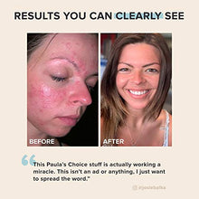 Load image into Gallery viewer, Paula's Choice CLEAR Regular Strength Acne Kit, 2% Salicylic Acid &amp; 2.5% Benzoyl Peroxide for Facial Acne &amp; Pores, Redness Relief, PACKAGING MAY VARY
