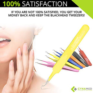 Blackhead Tweezer - Professional Curved Steel Tip Surgical Comedone & Splinter Extractor By Rapid Vitality. Ideal Blemish & Acne Remover Tool Means Flawless Facial Skin (Yellow)