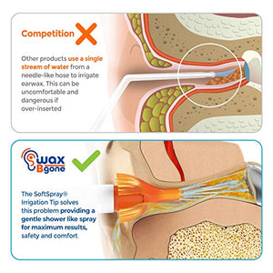 WaxBgone Ear Wax Removal Kit with Earwax Drops and SoftSpray Ear Irrigation Tips for Safe and Effective Earwax Removal - Complete Ear Cleaning Kit for Adults and Kids