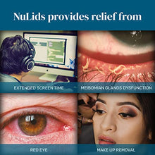 Load image into Gallery viewer, NuLids Dry Eye Relief Therapy Handheld Device, Long Lasting Alternative to Eye Drops &amp; OTC Treatments, For Irritated, Burning Eyes, Includes Eyelid Gel, Disposable Single-Use Soft Tips, 30 Starter Kit
