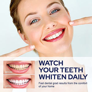 VieBeauti Teeth Whitening Kit - 5X LED Light Tooth Whitener with 35% Carbamide Peroxide, Mouth Trays, Remineralizing Gel and Tray Case - Built-In 10 Minute Timer Restores Your Gleaming White Smile