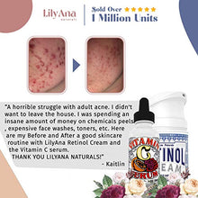 Load image into Gallery viewer, Vitamin C Serum for Face - Face Serum with Hyaluronic Acid and Vitamin E, Anti Aging Serum, Reduces Age Spots and Sun Damage, Promotes Collagen and Elastin - 1oz

