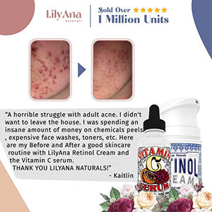 Vitamin C Serum for Face - Face Serum with Hyaluronic Acid and Vitamin E, Anti Aging Serum, Reduces Age Spots and Sun Damage, Promotes Collagen and Elastin - 1oz
