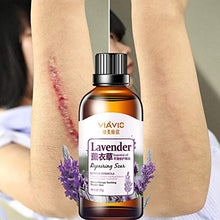 Load image into Gallery viewer, Taykoo Scar Repair Skin Essential Oil Lavender Essence Skin Care Natural Pure Remove Ance Burn Strentch Marks Scar Removal
