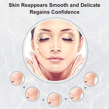 Load image into Gallery viewer, Scar Cream, Stretch Mark Cream, Acne Scar Removal Cream, Acne Spots Treatment, Burns Repair, Face Skin Repair Cream(50g)
