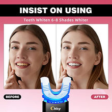 Load image into Gallery viewer, CHICY Teeth Whitening Kit with LED Light Technology Upgrade,Cooperate with New Carbamide Peroxide Teeth Whitening Gel 6X5ml, 5X Faster Than Whitening Strips,Effectively Remove All Kinds of Stain
