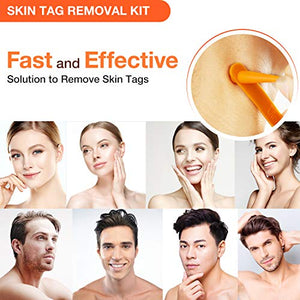 Skin Tag Remover, Skin Tag Removal Kit with 36 PCS Skin Tag Repair Patches, Efficient Skin Tag Remover Kit for Medium to Large Skin Tags