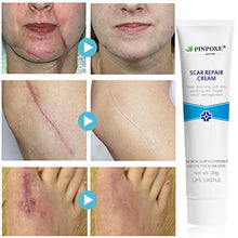 Load image into Gallery viewer, Scar Removal Cream, Scar Cream, Stretch Mark Cream, Natural Formula, Scar Gel Medical-Grade Silicone for Face, Body, C-Sections, Surgical, Burn, Acne Spots, Old &amp; New Scars, 20g
