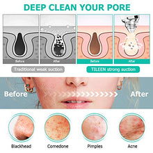 Load image into Gallery viewer, Blackhead Remover Vacuum, 5.0 MP Pore Vacuum with Camera Blackhead vacume Remover Pore Cleaner Suction Tool, Rechargeable Facial Comedone Acne Extractor for Men Women
