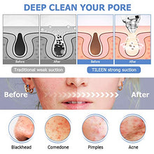 Load image into Gallery viewer, Blackhead Remover Pore Vacuum with Camera, 5MP WIFI Blackhead Vacume Facial Pore Cleanser Electric Acne Comedone Extractor, Rechargeable Blackhead Suction Tool for Men Women
