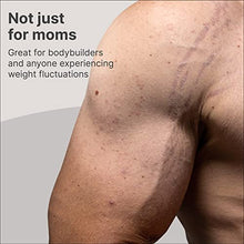 Load image into Gallery viewer, TriLASTIN Maternity Stretch Mark Prevention Cream (4oz) | Hypoallergenic and Paraben-Free | Stretch Mark Cream for Pregnancy | Skincare Gifts for Moms | Scar and Stretch Mark Remover Cream
