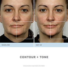 Load image into Gallery viewer, NuFACE Advanced Facial Toning Kit Trinity Facial Trainer Device + Hydrating LeaveOn Gel Primer Skin Care Device to Lift Contour Tone Skin + Reduce Look of Wrinkles AtHome System, White
