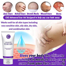 Load image into Gallery viewer, CSCS Most Effective Scar Remover Cream with Hydrolyzed Collagen &amp; Vitamin E - Heals Old &amp; New Scars from Cuts, Acne, Stretch Marks, Burns &amp; Post Surgeries Scars - Fast Results, for All Skin Types 2 oz
