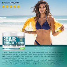 Load image into Gallery viewer, Scar Removal Cream - Effective Stretch Mark Removal - Natural Skin Repair - Acne Scar Remover Cream - Made in USA - Advanced Treatment for Old Scars &amp; Acne Scars - Clinically Proven Formula - 2 OZ
