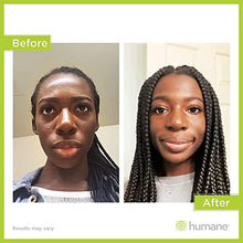 Load image into Gallery viewer, Humane Maximum-Strength Acne Wash - 10% Benzoyl Peroxide Acne Treatment for Face, Skin, Butt, Back and Body - 8 Fl Oz - Dermatologist-Tested Non-Foaming Cleanser - Vegan, Cruelty-Free

