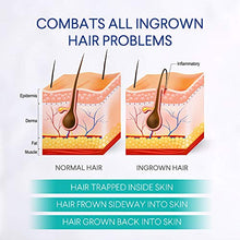 Load image into Gallery viewer, Evagloss Razor Bumps Solution- After Shave Repair Serum for Ingrown Hairs and Razor Burns, Roll-On for Men and Women -100g
