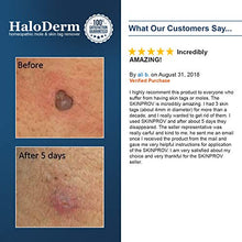 Load image into Gallery viewer, HaloDerm Advanced Skin Tag Remover &amp; Mole Remover - All Natural Skin Tag Cream - Remove up to 10 Skin Tags (FAST Results In As Little As 3-5 Applications) (1 Pack)
