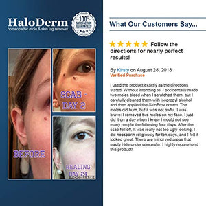 HaloDerm Advanced Skin Tag Remover & Mole Remover - All Natural Skin Tag Cream - Remove up to 10 Skin Tags (FAST Results In As Little As 3-5 Applications) (1 Pack)