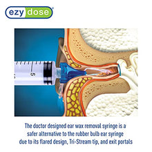 Load image into Gallery viewer, ACU-Life Ear Wax Removal Syringe
