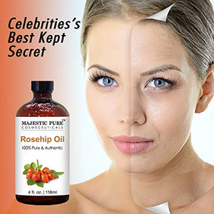 Majestic Pure Rosehip Oil for Face, Nails, Hair and Skin, Pure & Natural, Cold Pressed Premium Rose Hip Seed Oil, 4 oz