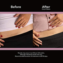 Load image into Gallery viewer, ScarAway Advanced Skincare Silicone Scar Sheets for C-Sections, Reusable Sheets (1.5” x 7”) for Hypertrophic and Keloid Scars from Injury, Burn, Surgery and more
