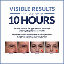 Load image into Gallery viewer, Plexaderm Rapid Reduction Eye Serum - Advanced Formula - Anti Aging Serum Visibly Reduces Under-Eye Bags, Wrinkles, Dark Circles, Fine Lines &amp; Crow's Feet Instantly - Instant Wrinkle Remover for Face
